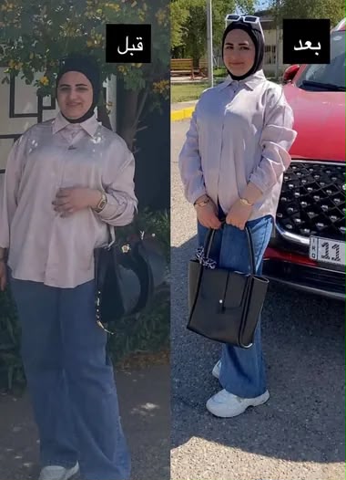 نتيجة مراجع 10 — قبل وبعد