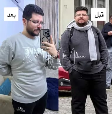 نتيجة مراجع 4 — قبل وبعد